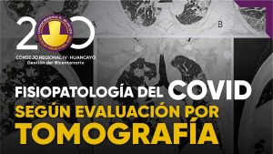 fisiopatologia-covid-tomografia